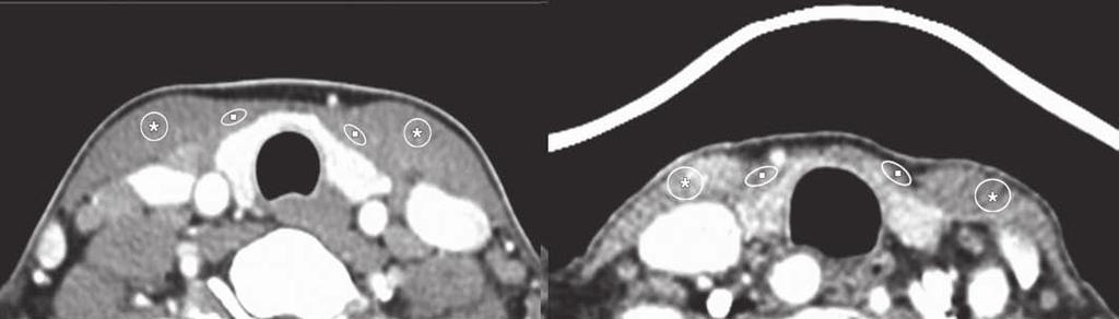 Fig. 3 Examples of measured values of mean CT attenuation and noise on neck CT images.