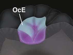Posterior restor ations Fig.18 - An increment of OcE is applied and sculpted to replicate natural occlusal anatomy.