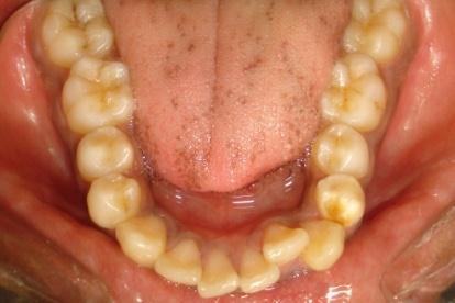 The periodontium and the temporo-