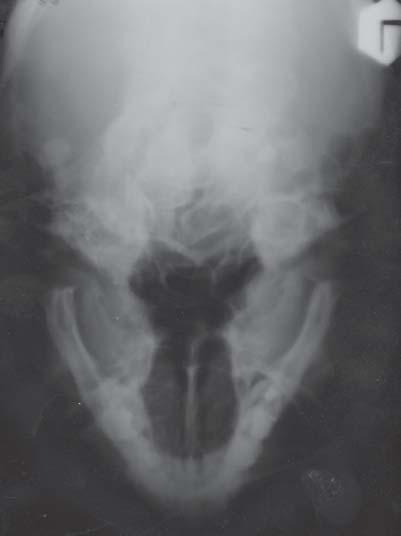 Figure presents axial x-ray of the mandible before surgery. Figure.