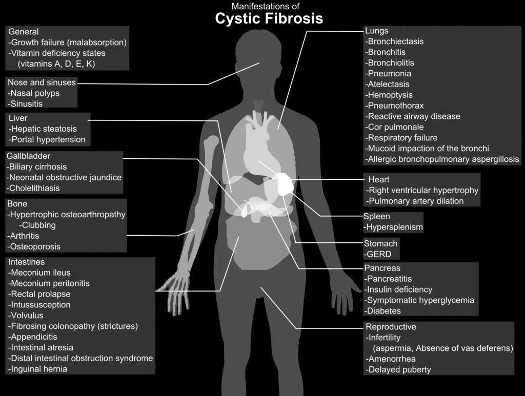 OF CYSTIC CLINICAL