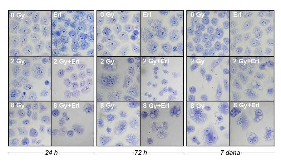 4.8 Morfološke promene CRL-5876 ćelija izazvane γ-zračenjem i erlotinibom Morfološke promene do kojih je došlo na CRL-5876 ćelijama nakon pojedinačnih i kombinovanih tretmana γ-zračenjem i