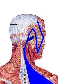 ascend behind the ear to the region above the ear where it then descends to bind at the mandible