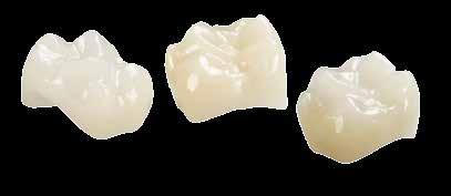 Because of the smooth shade transition between the dentin and incisal areas, these polychromatic blocks produce highly esthetic and natural-looking results, even without characterization.