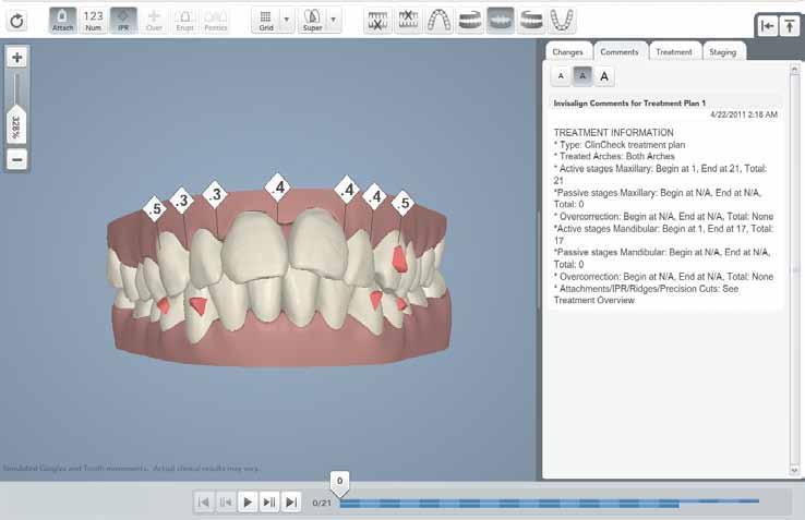 Treatment plans review. Tips Tricks. ClinCheck software is required to review all treatments. Install ClinCheck software from the Invisalign Doctors Site.