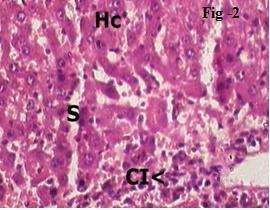 rats from normal control group showing Hc-Hepatic Cell, S-Sinusoid and normal cyto