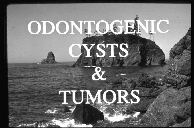 Origin of Odontogenic Cysts &