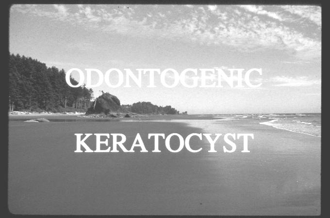 Odontogenic Keratocyst Because of its behavior, many oral pathologists now consider the OKC an odontogenic tumor that has a cystic form 2005 Classification by the W.H.O. Odontogenic Keratocyst (Keratocystic Odontogenic Tumor) Keratocystic Odontogenic Tumor Three important things associated with this diagnosis: 1.