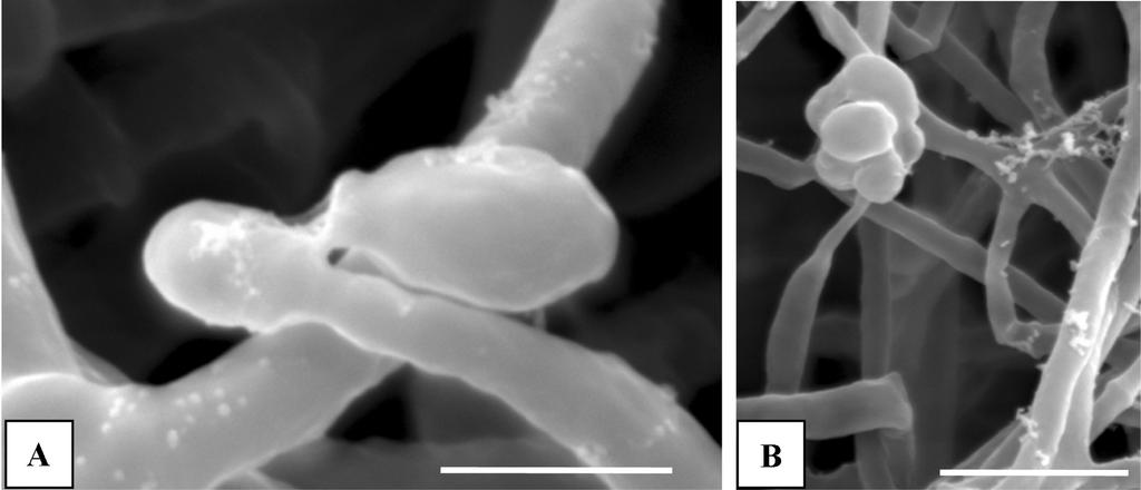 74 Shrestha et al. Fig. 6. Scanning electron micrographs showing conidia of Cordyceps militaris EFCC 11255 at various stages on five days after ascospore discharge on SDAY. A.