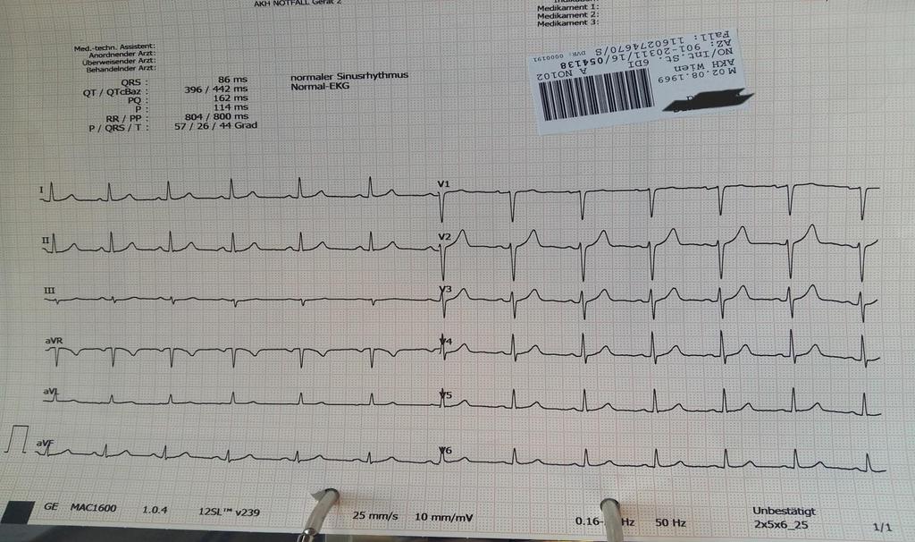 He was treated with vernakalant 3mg/kg i.v. in the ER.
