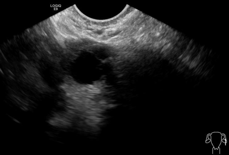 Ultrasound reports - Are they useful?