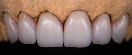 The final restorations that you deliver should match the patient receiving them, not some computer algorithm.