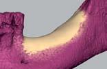 3D-model: occlusal view 5.