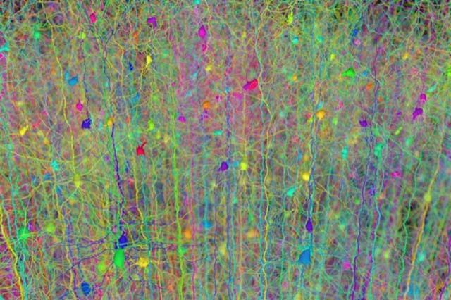 About 10 12 neurons - 1000 billion