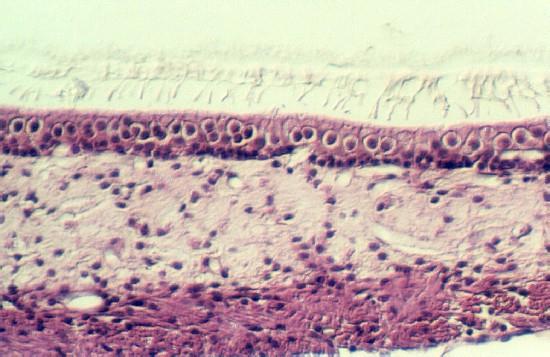Statoconia membrane in sacculus cellbio.utmb.