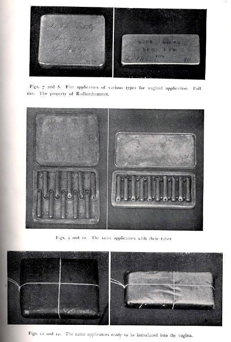 Summary Individualized Modern standardized Historical Paris Classical Stockholm method 1913-1914: Radiumhemmet, Stockholm, Sweden Stockholm Manchester Fletcher Applicator: Flat box (plate) Flexible