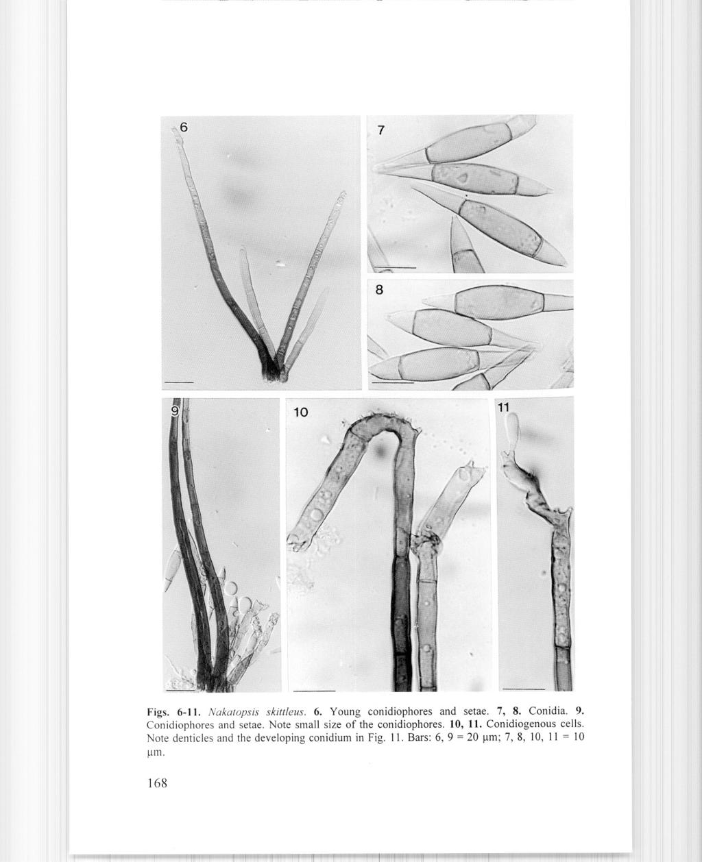11 /, Figs. 6-11. Nakatopsis skittleus. 6. Young conidiophores and setae. 7, 8. Conidia. 9. Conidiophores and setae.