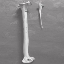 .. The long tibiotarsus of peahen indicated adaptive features for bipedalism and running whereas, the highly reduced fibula and fusion of tibia with proximal row of tarsals to form tibiotarsus