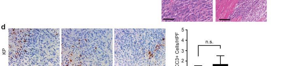 Histopathology of these UPS tumors were similar to prior reports using the KP mouse model 27.