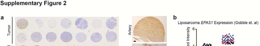 Supplementary Figure 2. HIF-2α inhibits tumor growth in other STS. a) Left: IHC staining of HIF-2α was performed on a tissue array containing normal arterial (Large Artery) and skeletal muscle (Skel.