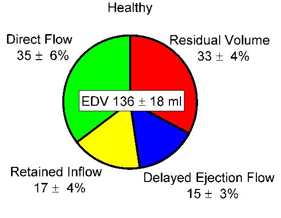 Cardiac flow patterns, healthy subject Direct Flow Retained Inflow