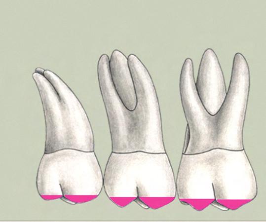 Understand the occlusal anatomy for fabricating temporary restorations, 13 LEARNING OBJECTIVES Identify the location of pits and fissures for sealants, 14 OPERATIVE UNDERSTAND THE OCCLUSAL ANATOMY
