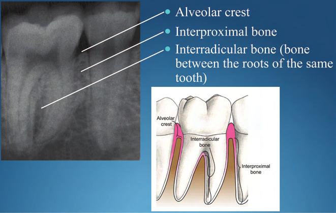 IDENTIFY PERIODONTIUM STRUCTURES ON A PERIAPICAL RADIOGRAPH Periodontology Perio Morphology PDF Periodontal anatomy
