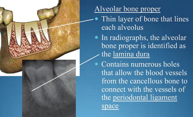 DENTAL RADIOLOGY IDENTIFY THE BONY AND PERIODONTAL LANDMARKS AND SURROUNDING STRUCTURES OF THE MAXILLA AND MANDIBLE