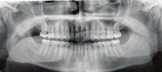 LOCATE AND DESCRIBE ANATOMICAL LANDMARKS Secondary Teeth Radiograph An interactive annotated X-ray introduces the name and location of anatomical structures.