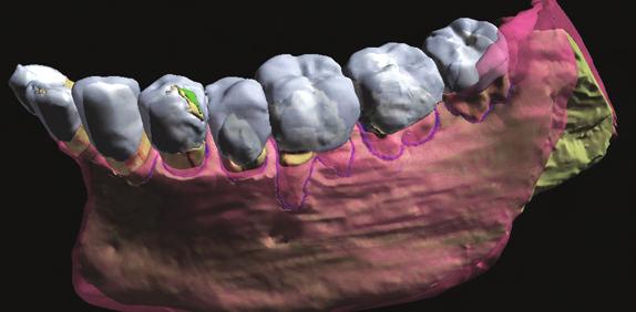 Describe the role of subgingival calculus in periodontal disease, 25 Discuss the effect of supragingival and subgingival calculus on periodontal disease, 26 IDENTIFY ANATOMICAL STRUCTURES Primary