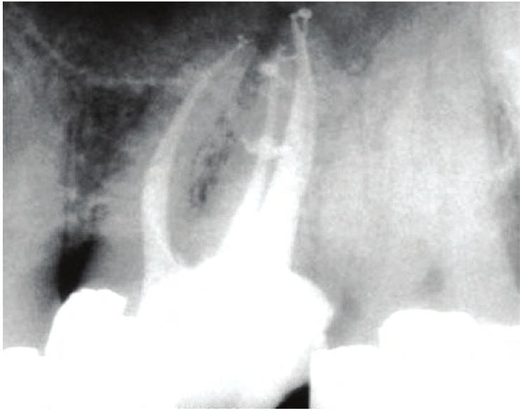 ORAL PATHOLOGY IDENTIFY ANATOMICAL STRUCTURES X-Ray Database Primary Teeth Secondary Teeth X-Ray Database Radiograph Radiograph 660 X-rays with searchable database for conditions and variations.