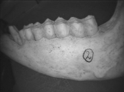 8) may be seen at P3 (complete wear of enamel with dentine fully