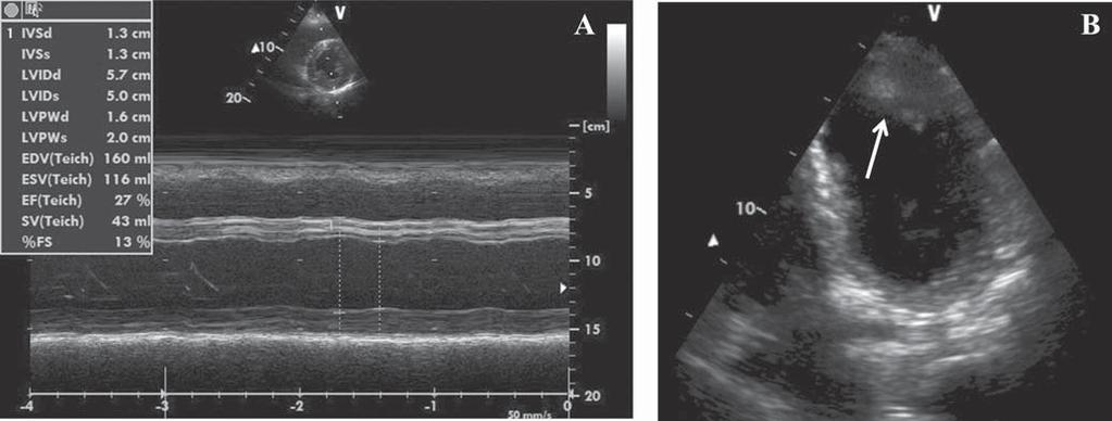 Figure 3. Echocardiographic images.