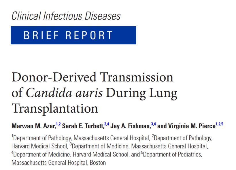 The donor: bronchiectasis The recipient: idiopathic pulmonary fibrosis BAL specimens: Candida haemulonii C. auris Invasive Aspergillosis 1 15% of the SOT recipients Azar MM, et al.