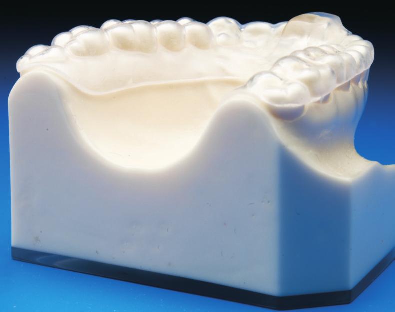 5mm invisible retainer-style full occlusal coverage Flat runner bar cuspid to cuspid for upper discluding element to function against Wear Duration & Treatment Planning Deprogrammers should only be