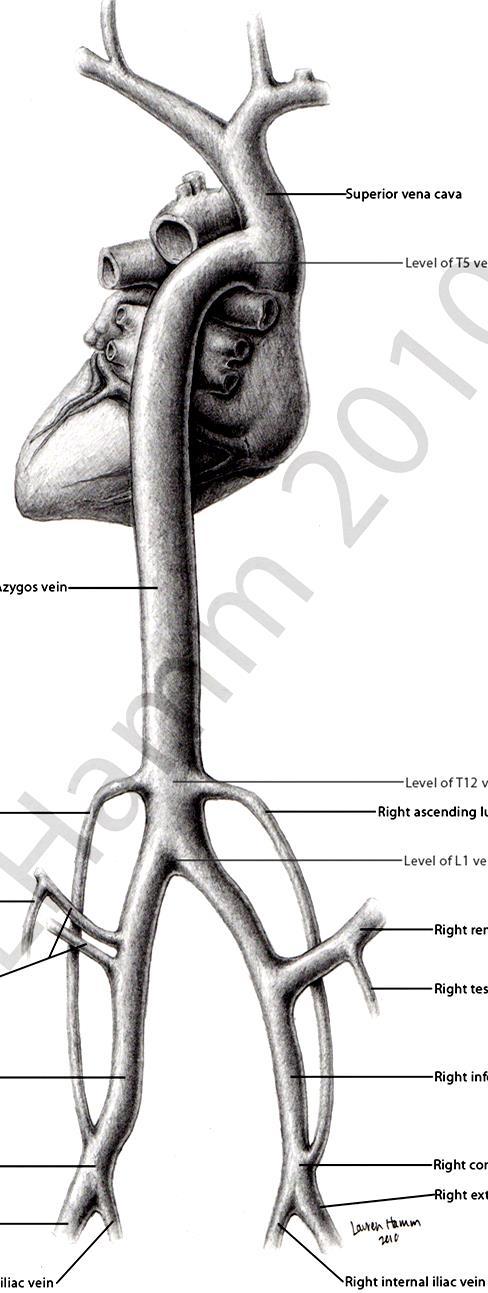 Inferior vena cava (IVC) Left Right IVC (prerenal segment): R. subcardinal v.