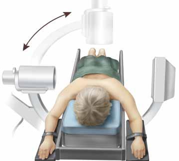 Patient Preparation and Positioning Anesthetize the patient appropriately. Position the patient prone on a radiolucent table.