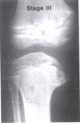 examination, and most importantly, radiographs of the knee joint '"$!