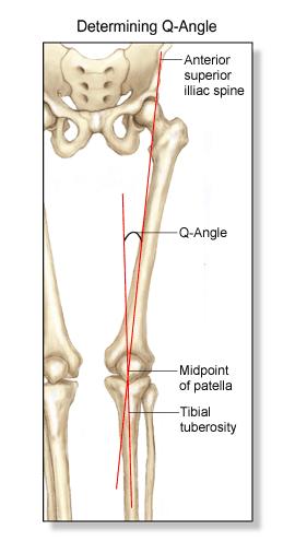 Pathological >18 o MCL sprain MCL sprain MOIs: Valgus force S/S: Severity dependent (1, 2, 3 ) 1 - pain, no laxity 2 - pain, w/ laxity - has endpoint 3 - pain w/laxity - no endpoint Tx: Out 1 wk-2