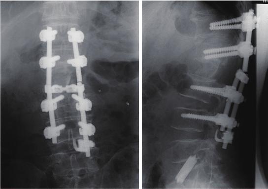200 Norimitsu Wakao et al. Fig. 4 a b c CT images after primary operation.