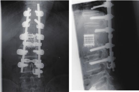 a: CT axial view, b: CT sagittal reconstruction image.