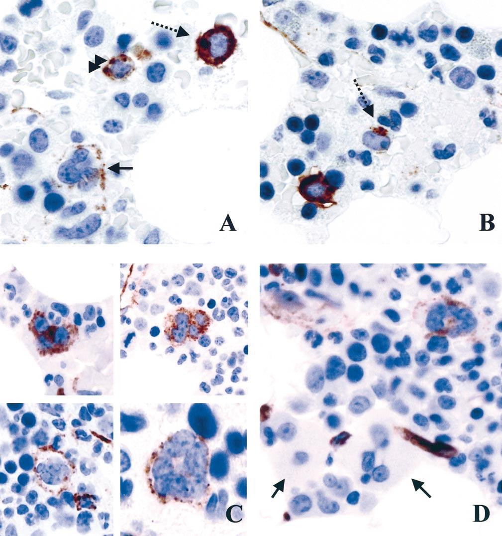 Figure 3. Bone marrow trephine sections immunostained by QBEND10.