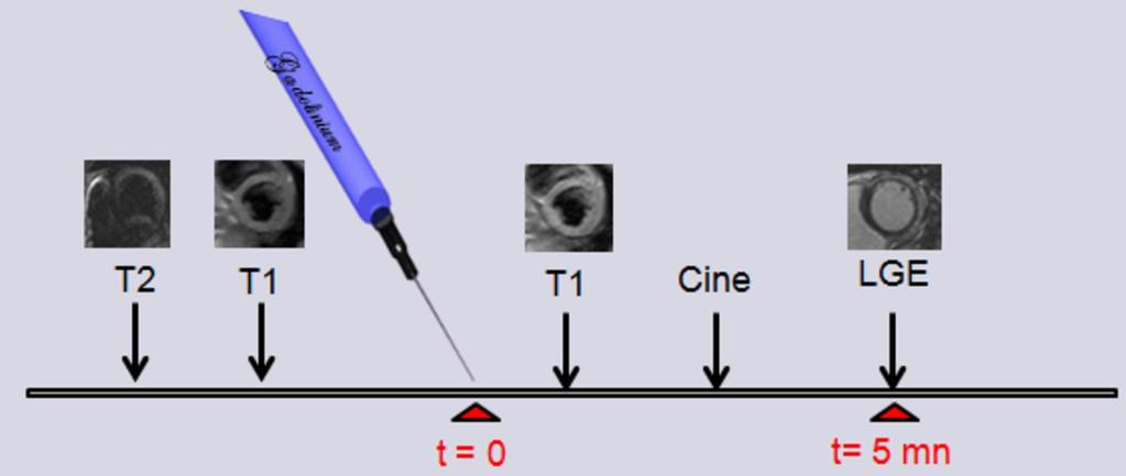 Performing Cine MR after gadolinium perfusion # Shortens the examination time by 5 to 10 minutes # Increases the sensitivity in depicting myocardial lesions Fig.