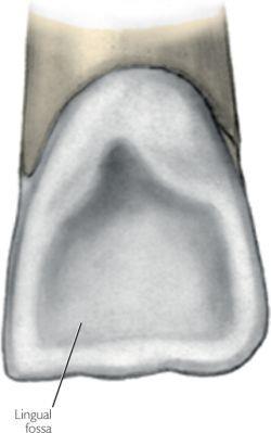Variations of 11, 21 Shovel-shaped incisor www.fossa-medicaldictionary.