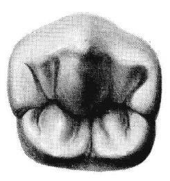 Permanent Mandibular Second Premolars