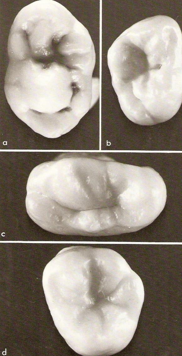 Molars B.S.