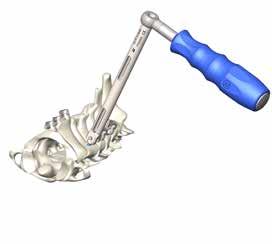8. FINAL TIGHTENING To perform the final tightening engage the Counter Torque to the pedicle screw