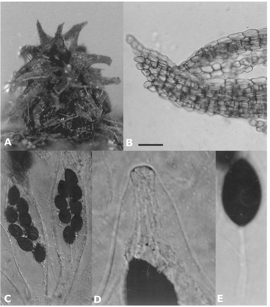 CHANG and WANG A new species of Podospora 171 Figure 2. Podospora multipilosa. A, perithecium on substrate; B, large tufted hairs; C, asci; D, upper part of an ascus; E, ascospore.