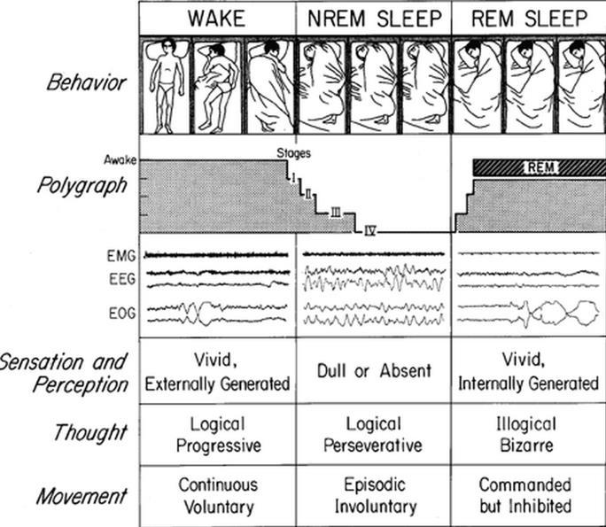 SLEEP : Stages and Sleep Study Diagnostics Polysomonography ( PSG) Out
