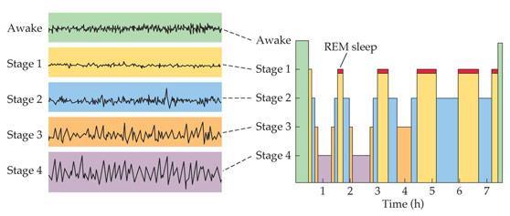 Sleep patterns of EEG There are two different kinds of sleep: Rapid eye movement sleep (REM-Sleep) Non-REM sleep (NREM sleep)/